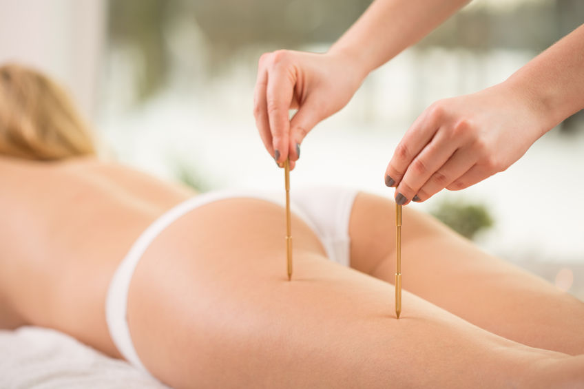 42076417 - therapist pressing acupuncture points on young woman's leg