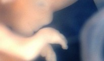 embryo