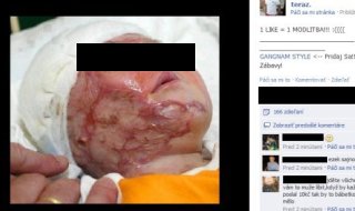 Fotografia popáleného dieťaťa na facebooku